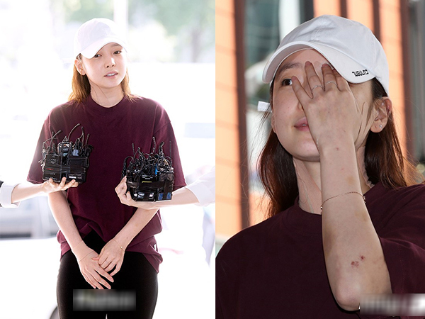 'Nữ thần' Goo Hara lộ mặt biến dạng, người đầy vết thương sau scandal bạo hành