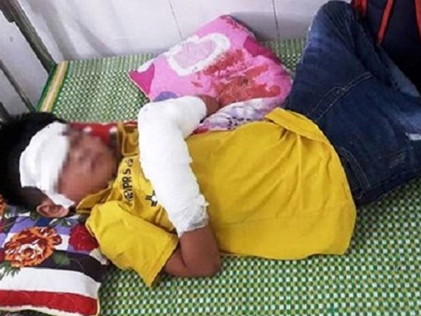 Nghệ An: Điện thoại đang sạc phát nổ, cháu bé 7 tuổi bị dập nát tay