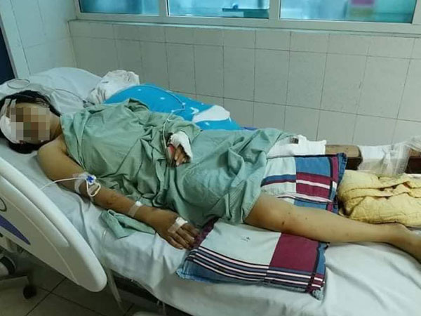 Vụ tai nạn giao thông khiến 13 người tử vong tại Lai Châu: Thoát cửa tử nhưng đối mặt với tận cùng nỗi đau