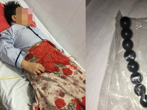 Vụ đứa trẻ bị bạn ép nuốt 9 viên bi nam châm: Hãy dạy trẻ cách yêu bản thân