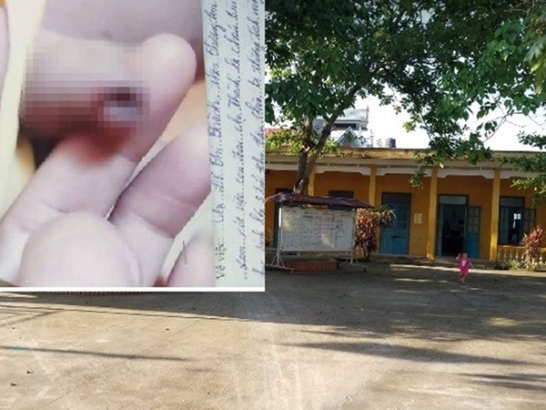 Phụ huynh đưa bằng chứng, tiếp tục 'tố' giáo viên đánh vào bộ phận sinh dục bé 3 tuổi