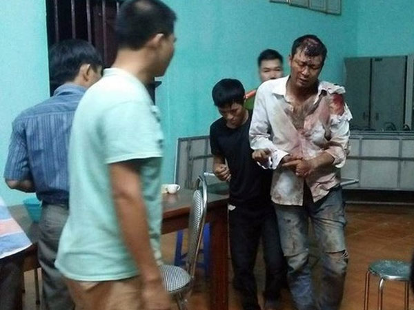 Hai thanh niên Hà Nội lên Hòa Bình trộm dê bị người dân đánh nhập viện