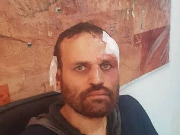 Kích nổ 'áo bom' tự sát nhưng bất thành, thủ lĩnh khủng bố khét tiếng của Al-Qaeda bị bắt sống
