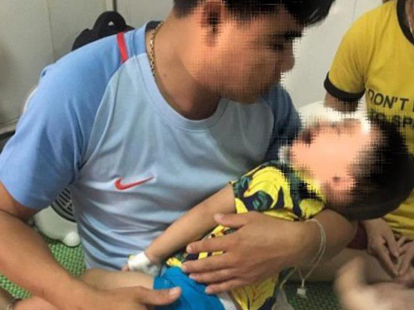 Bé trai 2 tuổi bị chó becgie nhà nuôi cắn rách nhiều vùng trên mặt