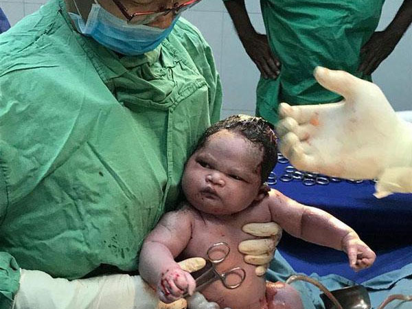 Em bé 'gây bão' vì chào đời không thèm khóc, chưng ngay vẻ mặt: 'Sao lại lôi cháu ra đây!'