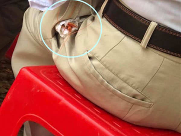 Ai cũng bật cười vì con tôm thò râu loe ngoe trong túi quần người đàn ông, nhưng biết sự thật lại rơm rớm lệ