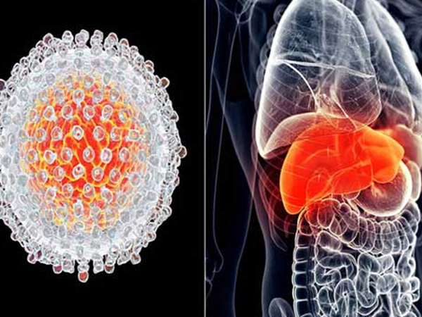 Có 7 triệu chứng này kéo dài 2 tuần: Hãy đi khám ung thư gan để giữ cơ hội sống cao nhất