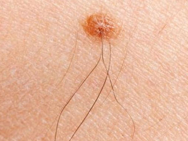 Phát hiện những 'điểm lạ' này trên cơ thể là điềm báo may mắn đang đến gần, bạn sắp phát tài rồi đấy