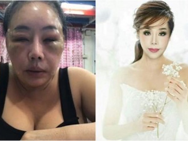 Nữ đại gia 14 đời chồng đã 'lột xác' như gái đôi mươi nhưng lý do cuộc trùng tu nhan sắc này mới thật sự khiến người ta kinh ngạc
