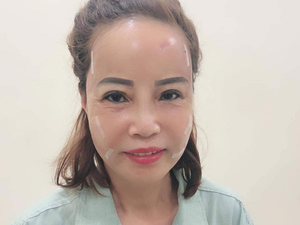 Tiết lộ sốc của cô dâu 62 lấy chồng 26 tuổi về diện mạo mới như thiếu nữ 18