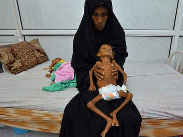 Yemen đứng trước 'nạn đói kinh hoàng nhất lịch sử nhân loại'