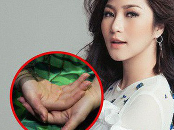 Hương Tràm stress tự bóc tay rỉ máu: Bác sĩ cảnh báo Hội chứng nguy hiểm gây chết người