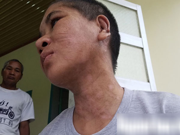 Tra tấn dã man người làm, Nga 'vọc' lãnh án 10 năm tù