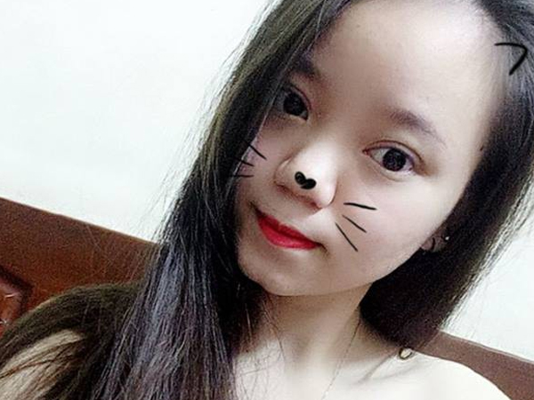 Nỗi khổ bất tận của những cô nàng có trán 'sân bay': Trán đi trước, người lả lướt theo sau!