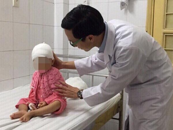 Bé gái 19 tháng tuổi mắc dị dạng hộp sọ hiếm gặp