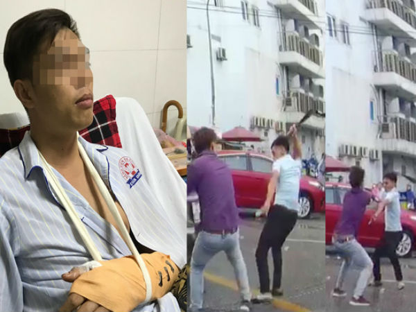 Vụ chặt tay tài xế ô tô: Nạn nhân bị đứt động mạch, máu phun không ngừng khi vào bệnh viện