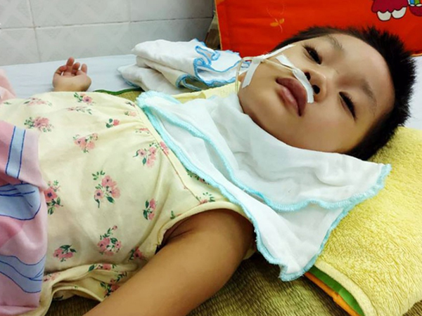 Bé gái 5 tuổi bị viêm màng não tự miễn sau cơn co giật, hơn 1 tháng không thể ngủ và liên tục la hét