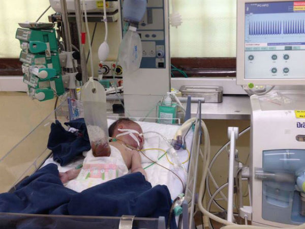 Chồng đỡ đẻ cho vợ tại nhà đau đớn phát hiện con gái bị lòi ruột ngoài bụng
