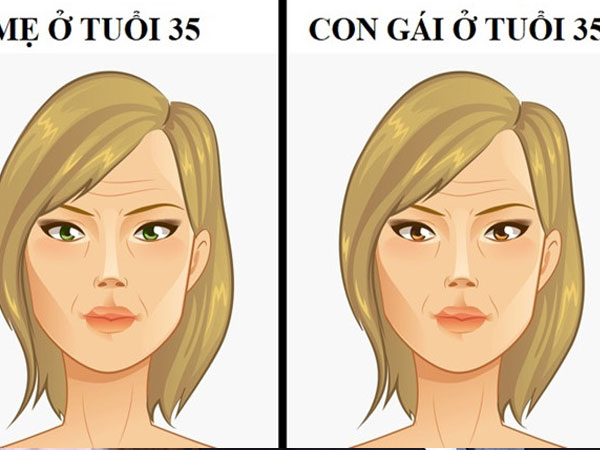 Con gái có thể mắc bệnh di truyền nào từ mẹ?