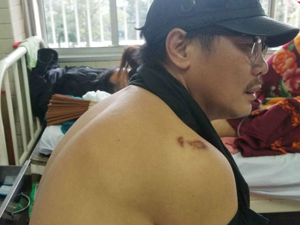 Đạo diễn trường Sân khấu: Lái xe ôm hút cần sa, tôi ngồi sau nên dương tính