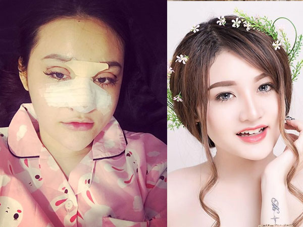 Hot girl từng náo loạn phố Nguyễn Huệ: Liên tục 'dao kéo' vì bị gọi là 'Mặt vuông'