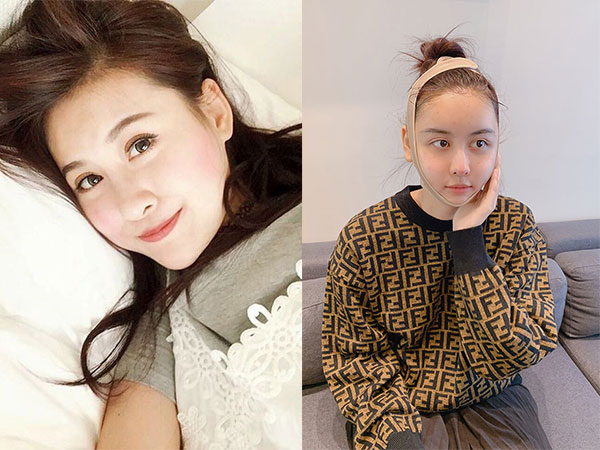 Không còn giấu diếm nữa, Hà Lade giờ đây đã tự tin công khai đăng ảnh sang Hàn Quốc thẩm mỹ rồi!