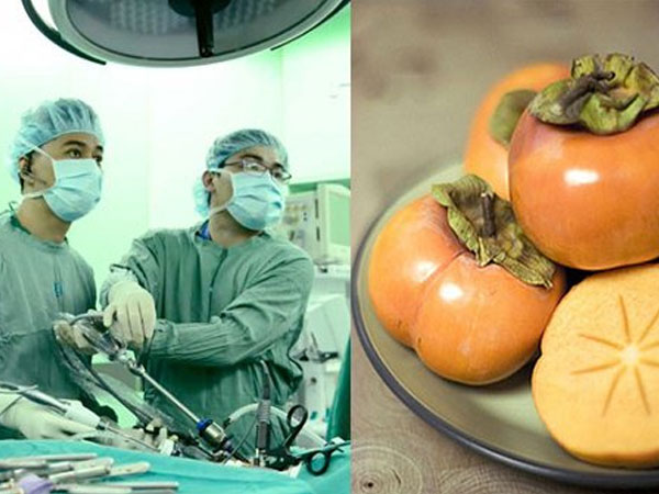Ăn 10 trái hồng, người phụ nữ nhập viện cấp cứu vì tắc ruột