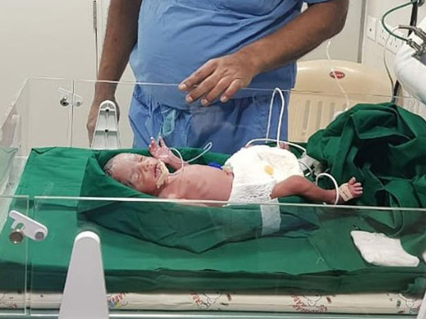 Bé gái châu Á đầu tiên ra đời nhờ cấy ghép tử cung của bà ngoại
