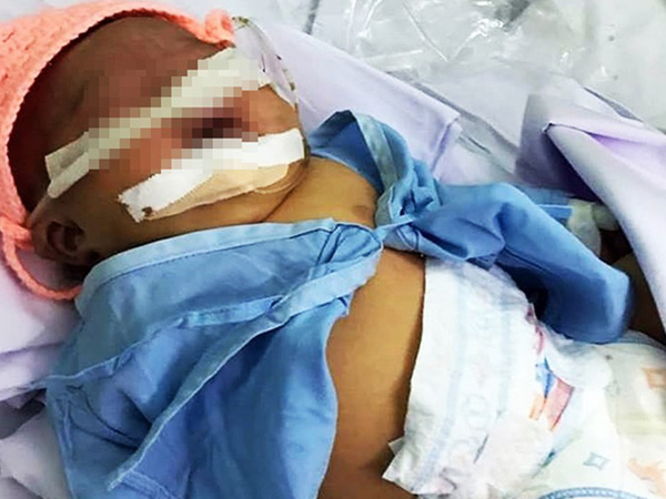 Bé gái nặng 4kg nhưng cho sinh thường ở Bình Thuận bị tổn thương thần kinh cánh tay và hôn mê