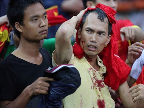 Đêm kinh hoàng: CĐV Malaysia đánh CĐV Việt Nam đổ máu ở AFF Cup 2014