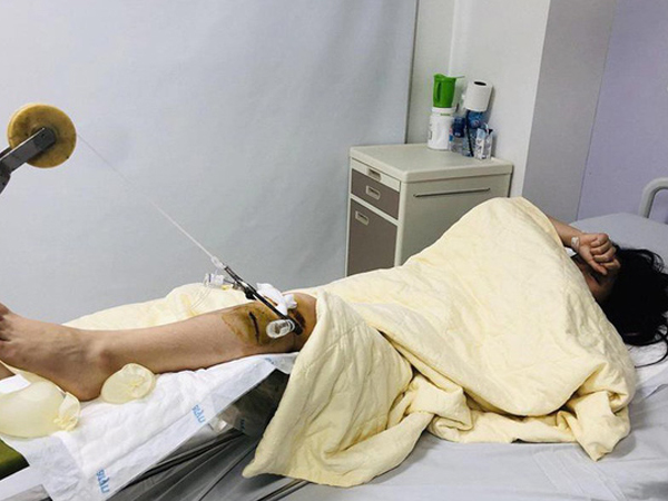 Tâm sự nghẹn ngào của người bố có con gái bị xe sang đâm nguy kịch rồi bỏ chạy