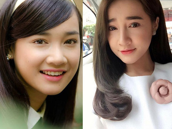 Đã đẹp sẵn rồi, Huyền Baby, Thúy Vi, Nhã Phương... vẫn sửa mặt