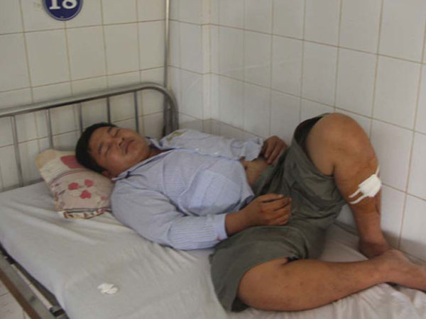 Chém 4 công an nhưng không bị xử lý hình sự vì tâm thần
