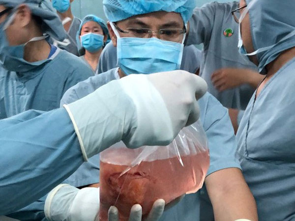 Mẹ quyết sinh con ra để lấy tạng cho người khác