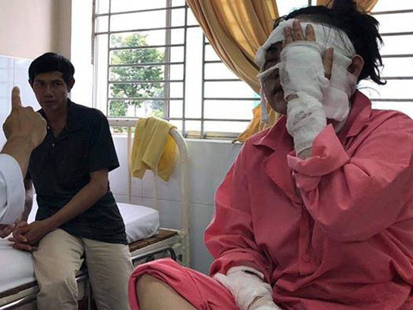 Cô gái bị tạt axit hỏng 2 mắt ở Sài Gòn hé lộ về thủ phạm, nghi vấn vợ bạn đứng sau