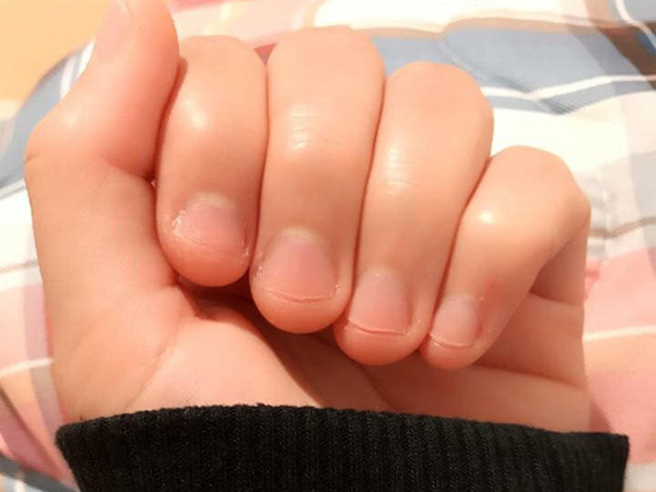 Có một kiểu người móng tay chẳng bao giờ nhú lên được vì cứ rảnh là ngồi cắn