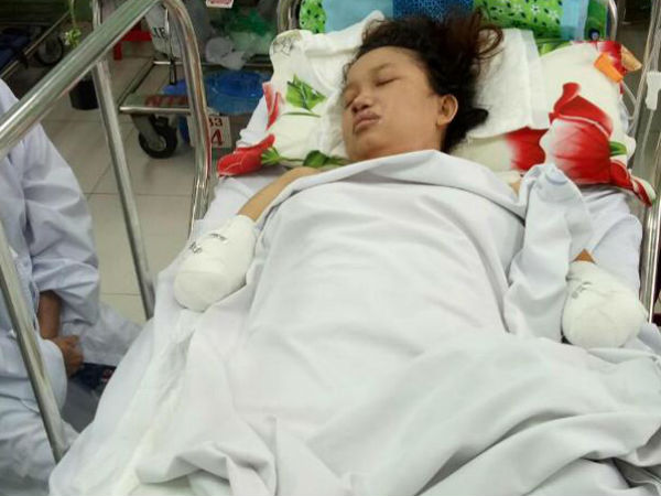 Tưởng chỉ bị tắc sữa, mẹ Bình Dương nuốt nước mắt đành cắt cụt tứ chi để được sống