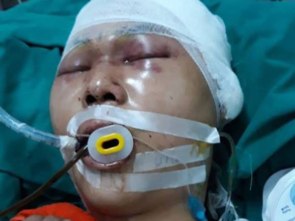 Hà Nội: Nam sinh cấp 3 bị nhóm người lạ đánh chấn thương sọ não ngay trước cổng nhà