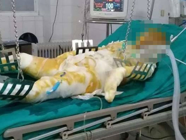 Điện Biên: Đang ở cùng 5 con nhỏ, vợ bị chồng tẩm xăng đốt tử vong
