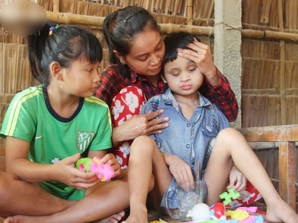 Bố bị chấn thương sọ não, con trai mù 6 tuổi gục đầu lên vai mẹ, ú ớ lấy lá dừa hốt cát để ăn