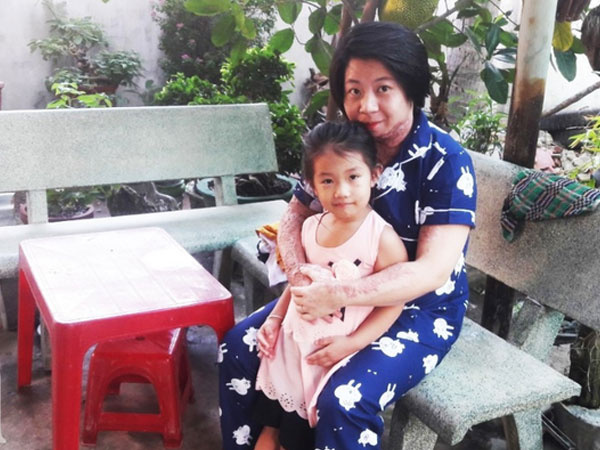Người vợ bị chồng dùng xăng đốt vì níu kéo tình cảm không thành: 'Tết này em được về với con rồi'