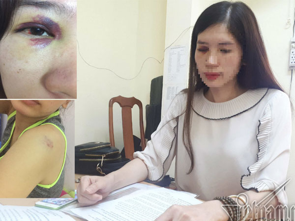 Cấp giấy chứng nhận kết hôn cho người lấy 2 vợ khi chưa… ly hôn