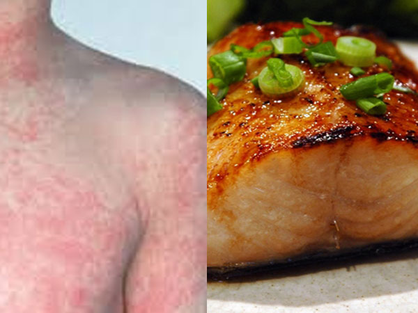 Cậu bé 11 tuổi tử vong vì căn bệnh triệu người mắc nhưng ít để ý