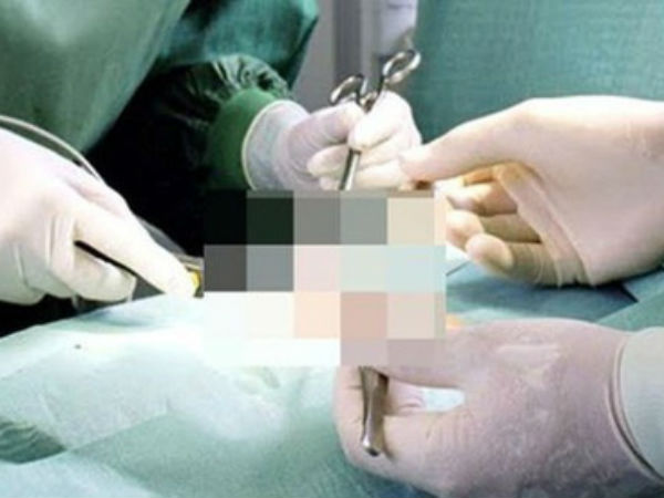 Quý ông U60 bị bạn tình 'ghen ngược', cắt phăng 'của quý'