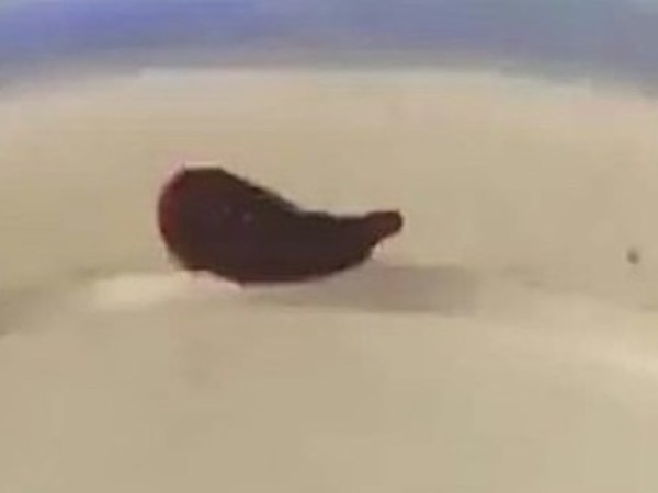 Con vắt dài 5 cm sống trong mũi người phụ nữ