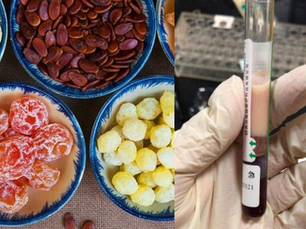 Máu của người phụ nữ trắng như sữa, vì ăn quá nhiều đồ vặt ngày Tết