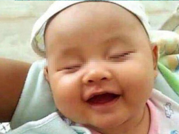 Bé 6 tháng thường cười khi ngủ, bà khen đáng yêu nhưng mẹ đưa đi khám thì hối hận