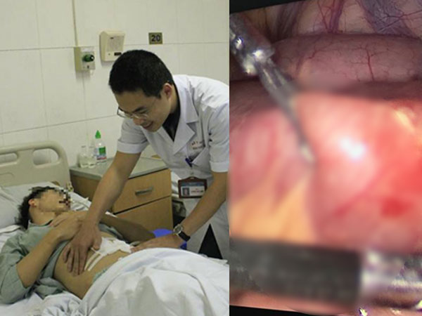 Thanh niên Hà Nội thủng ruột sau khi ăn cơm suất