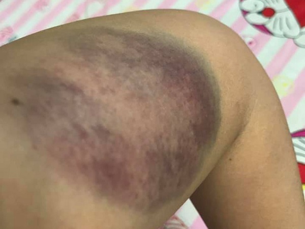 Kỷ niệm lễ Tình nhân, chồng đánh vợ mới sinh thừa sống thiếu chết phải nhập viện gây phẫn nộ cộng đồng mạng