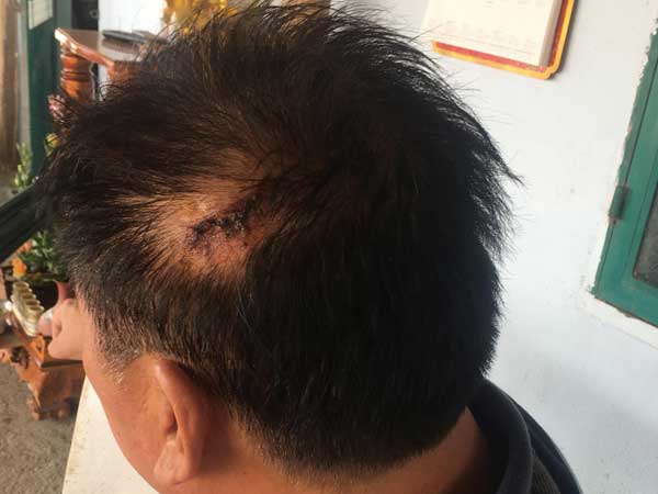 Giám đốc doanh nghiệp ở Sài Gòn bị 'giang hồ' truy sát